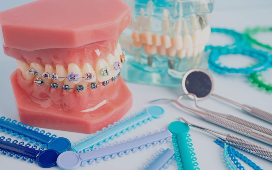 Risks & Benefits of Orthodontic Treatment